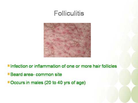 Dermatological Infections