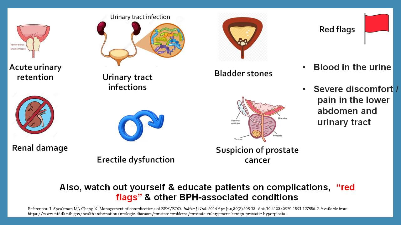 Structured Health Education Programme For Patients with BPH / LUTS