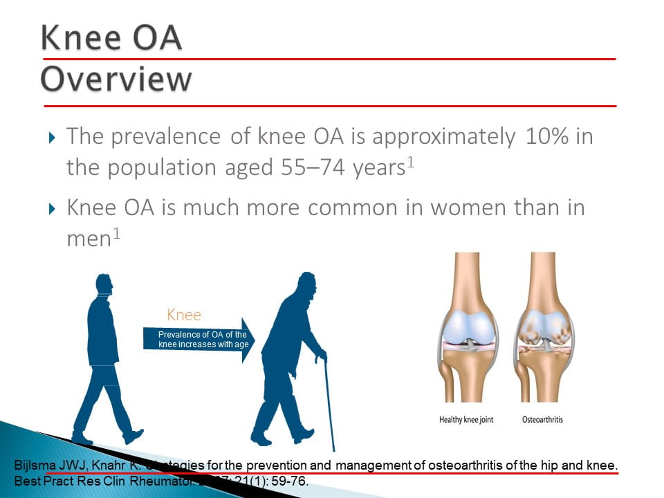 Management Of Young Osteoarthritic Knee- Role Of Viscosupplementation