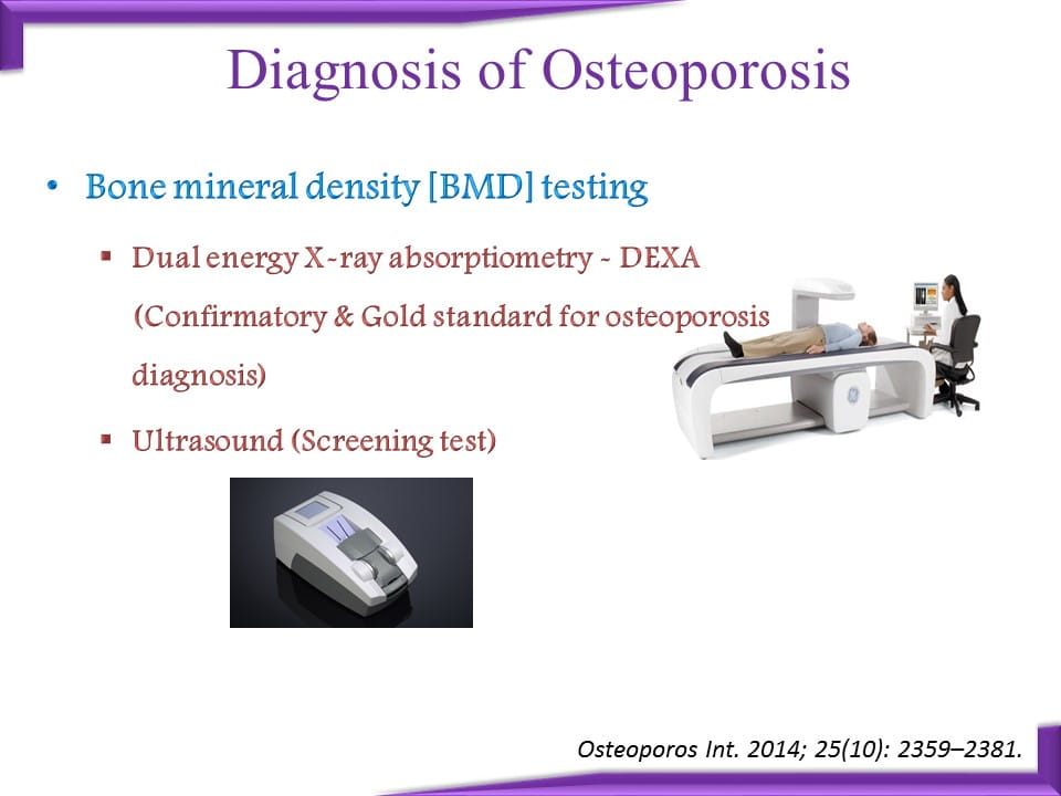 Role Of Teriparatide In Severe Osteoporosis