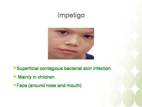 Dermatological Infections