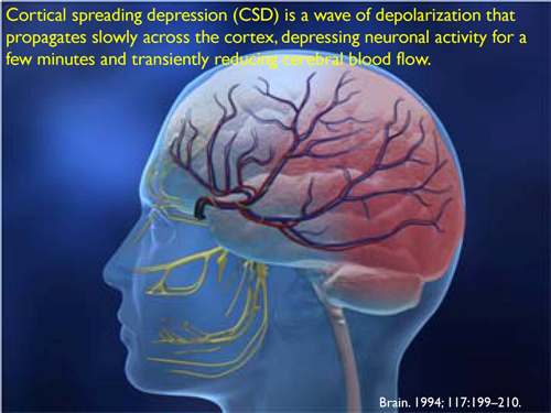 Migraine And It's Management