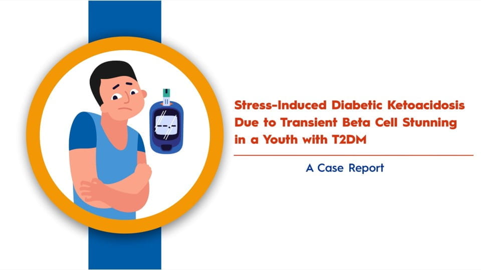 Stress-Induced Diabetic Ketoacidosis Due to Transient Beta Cell Stunning in a Youth with T2DM